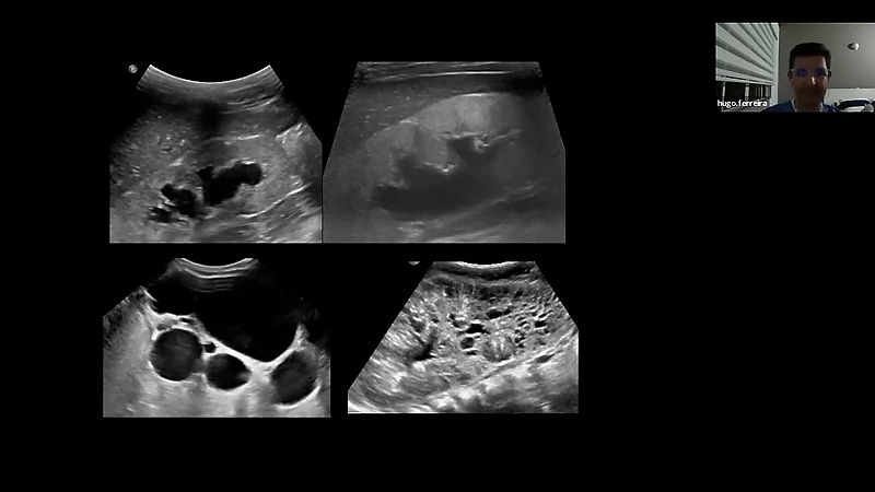 Taller Imágenes en Urología Pediátrica Parte 1